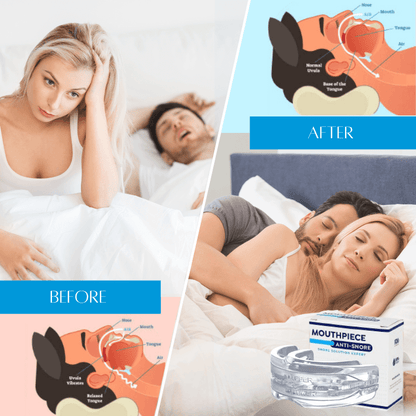 SleepEazy™ - Anti-snoring Mouthpiece